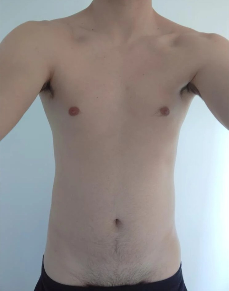 Profilo di Pierre-anthony